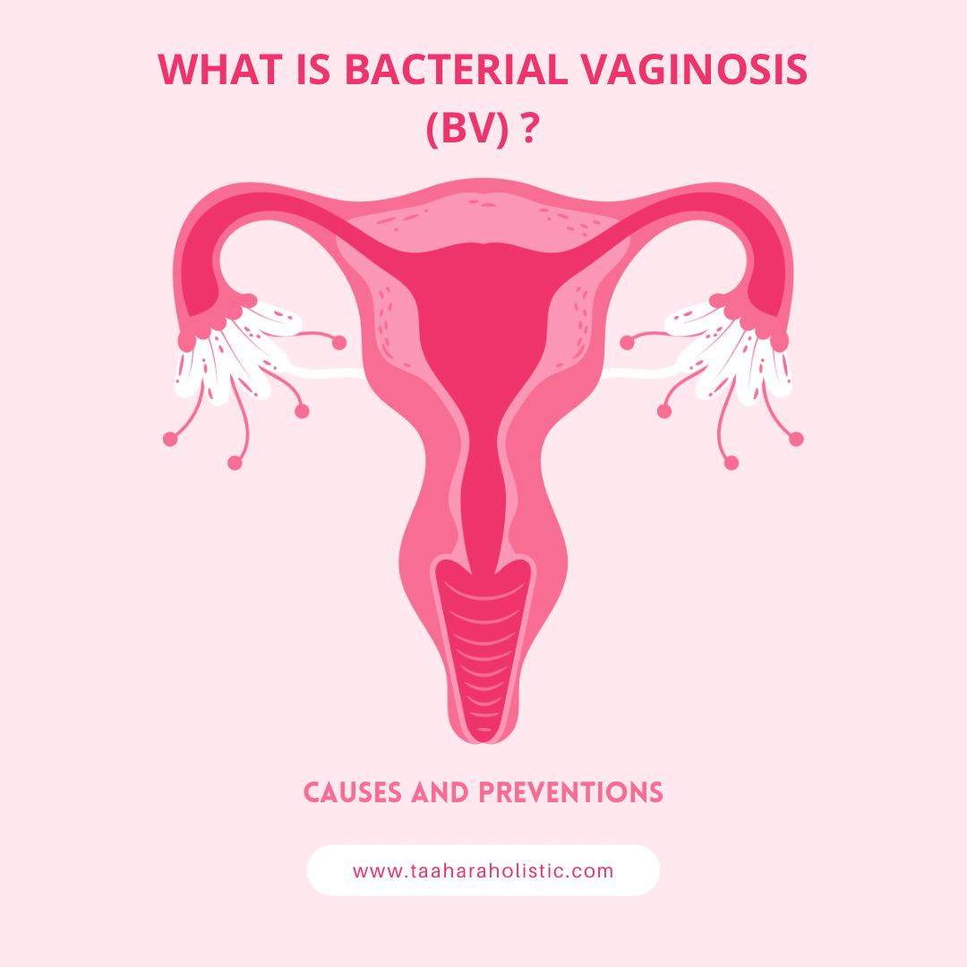 What is Bacterial Vaginosis (BV) ?
